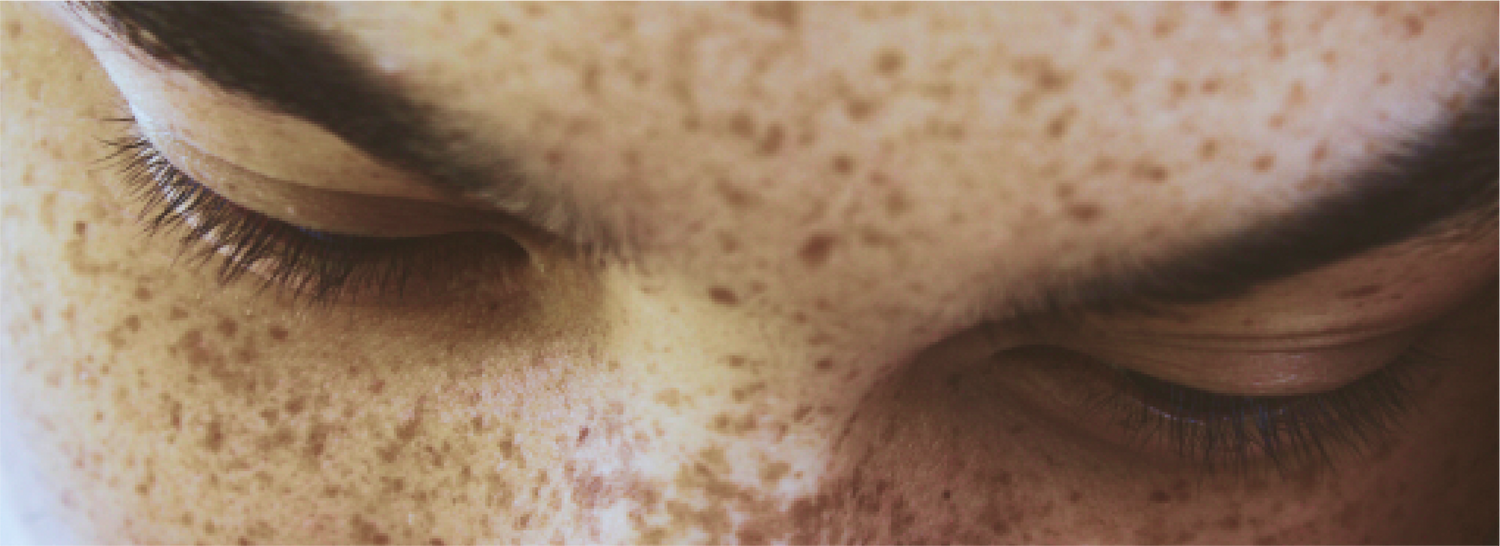 banner-close-up-face-with-freckles